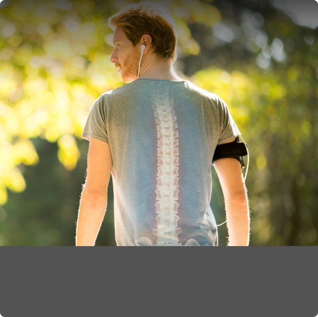 Anterior Lumbar <br class="hidden md:block"/>Interbody Fusion (ALIF) - Minimally invasive spine surgery procedure